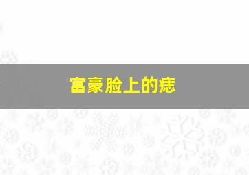 富豪脸上的痣,富豪脸上的痣图片