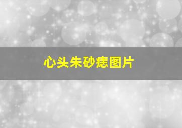 心头朱砂痣图片,心头朱砂痣图片大全