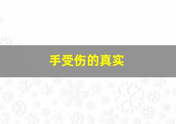 手受伤的真实,手受伤的真实图片轻微