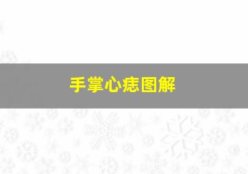 手掌心痣图解,手掌心痣的位置与命运图解