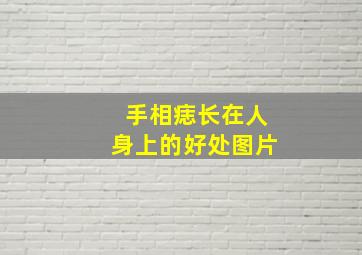 手相痣长在人身上的好处图片