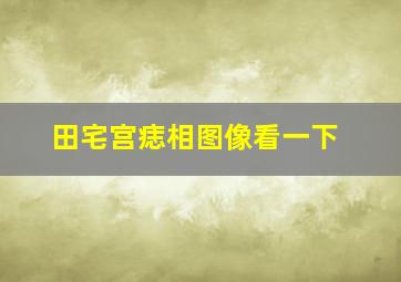 田宅宫痣相图像看一下,田宅宫有痣的女人好不好