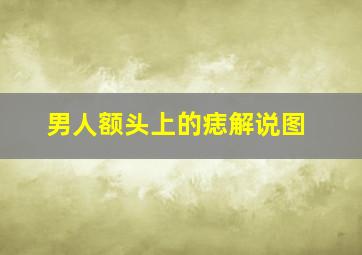 男人额头上的痣解说图,男人额头有痣面相