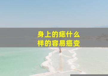 身上的痣什么样的容易癌变,身上什么样的痣会癌变